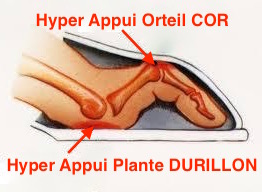 griffe-orteil-2